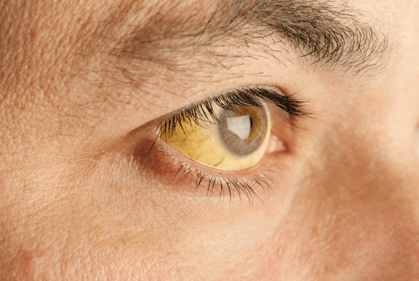 Yellow Eyes Yellow Eyes